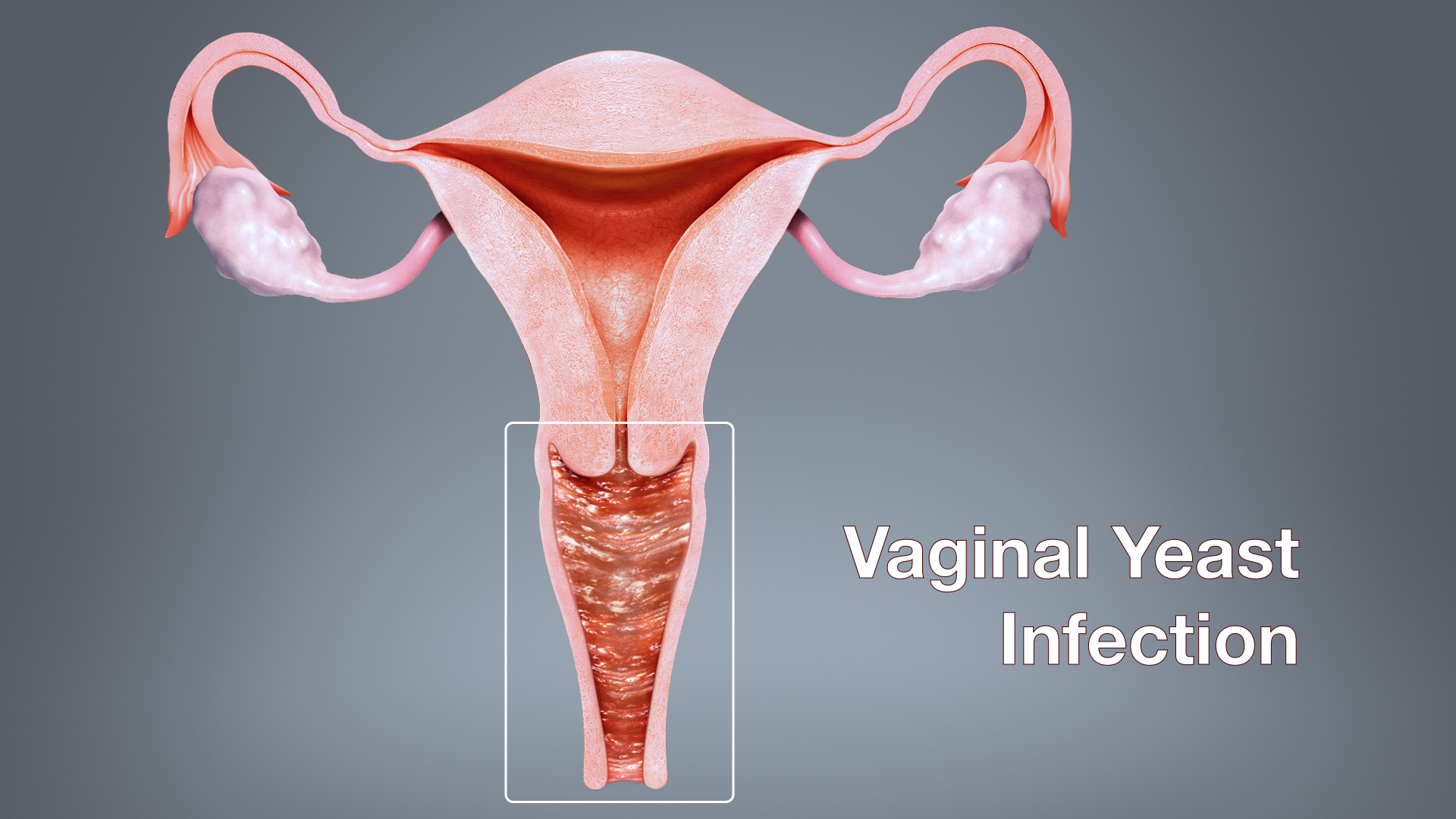 Vaginal Yeast Infections Treatment Guntur